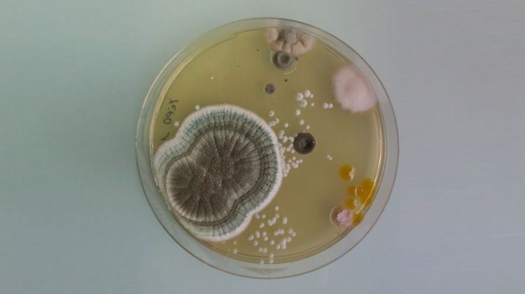 Mikrobia yang dibiakan dalam petri dish