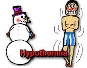 Hypothermia Itu Bukan Kesurupan Kawan. Pahamilah!