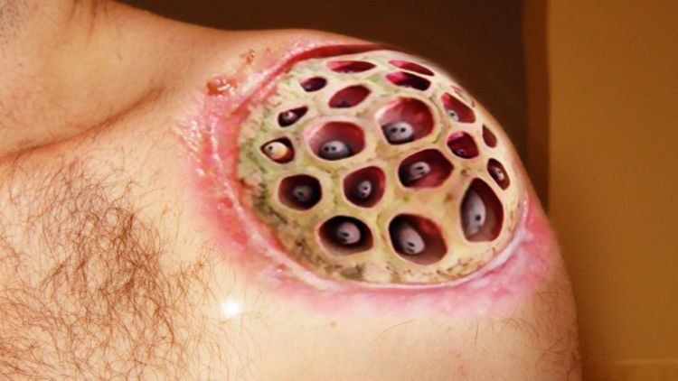 TRYPHOPHOBIA!