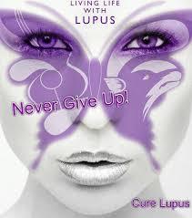 Mari Berkenalan Dengan Lupus, Sebelum Kamu Bilang Dia Menular!