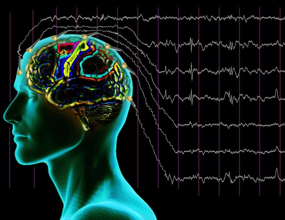 Mengenal Lebih Jauh tentang Epilepsi. Yuk, Kenali lebih Dalam