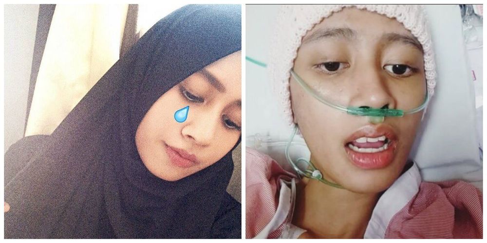 Belajar Memaknai Hidup dari Loly; Gadis Cantik yang Membuat Kita Lebih Waspada Terhadap Kanker