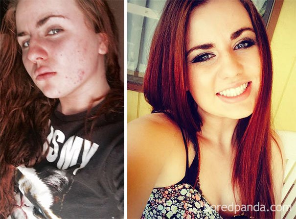 before-after-drug-addiction-102-5862649939ffc__605