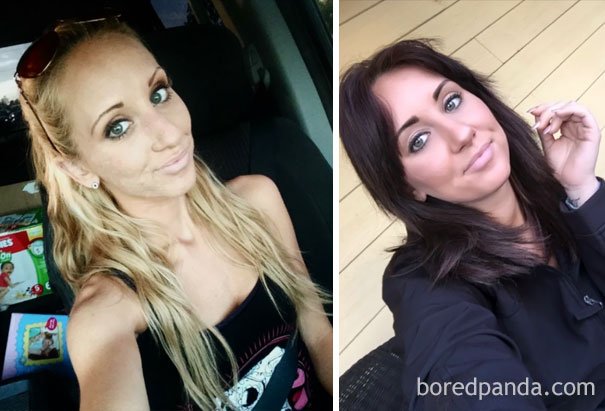 before-after-drug-addiction-2-585b9be33c239__605