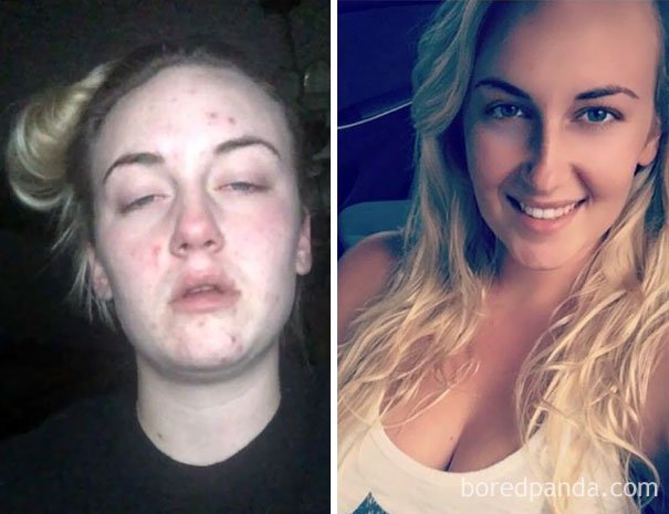 before-after-drug-addiction-54-585d1b2a0fb13__605