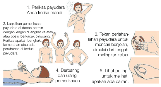 Periksa Payudara Mandiri