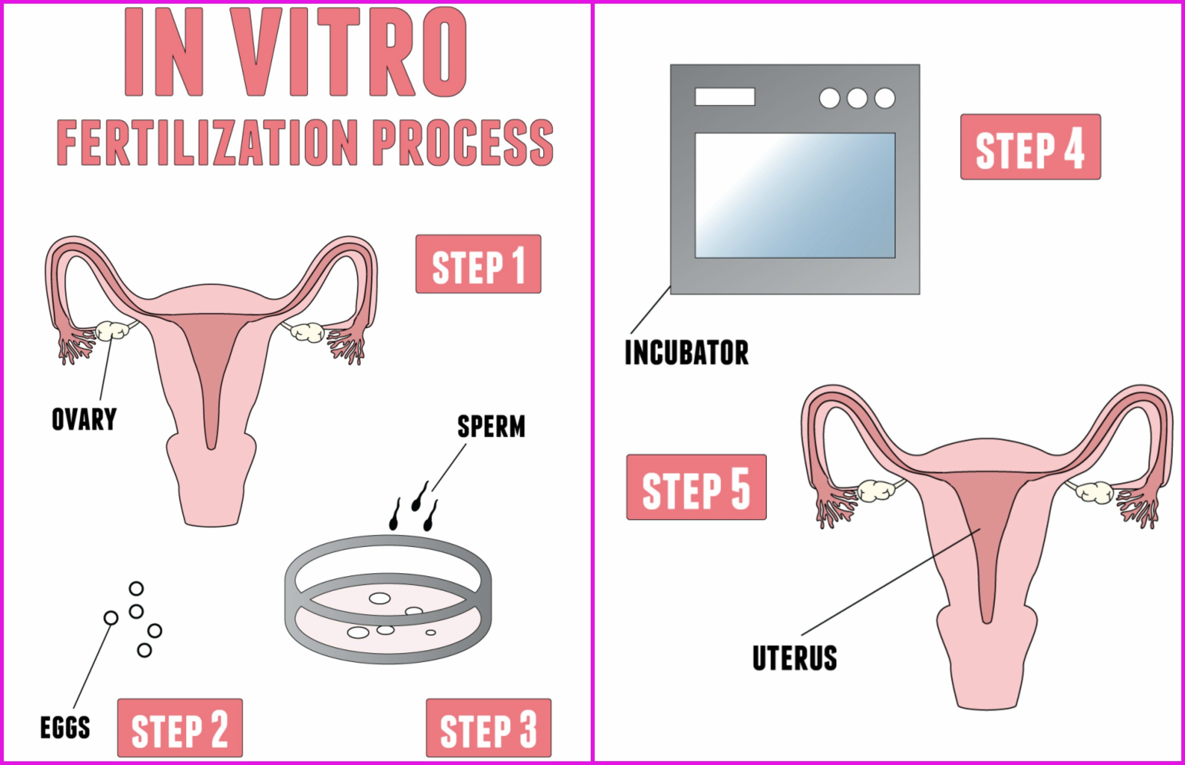 Diagram IVF.