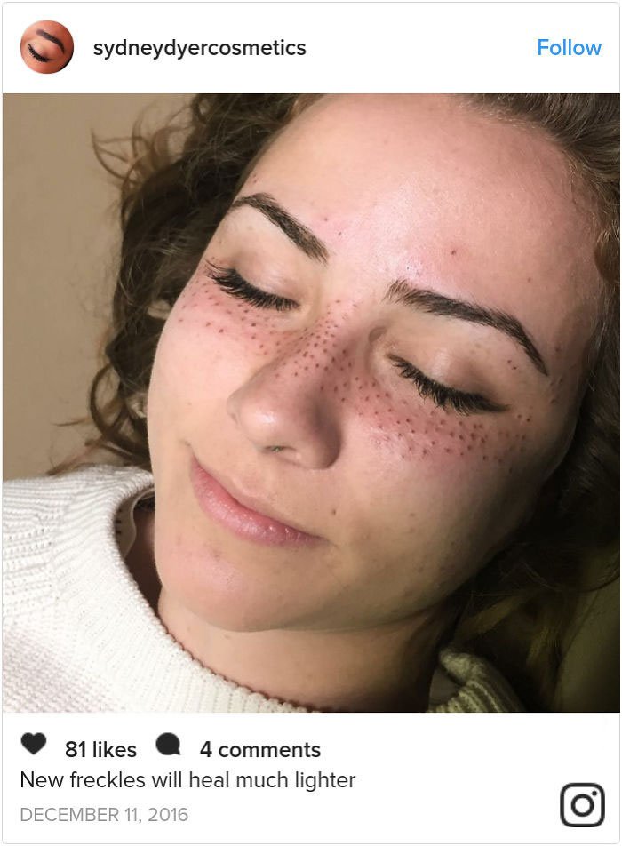 12 Potret Trend Tato Freckles. Makin Banyak Fleknya, Makin Cantik Kelihatannya. Ada-ada Saja!