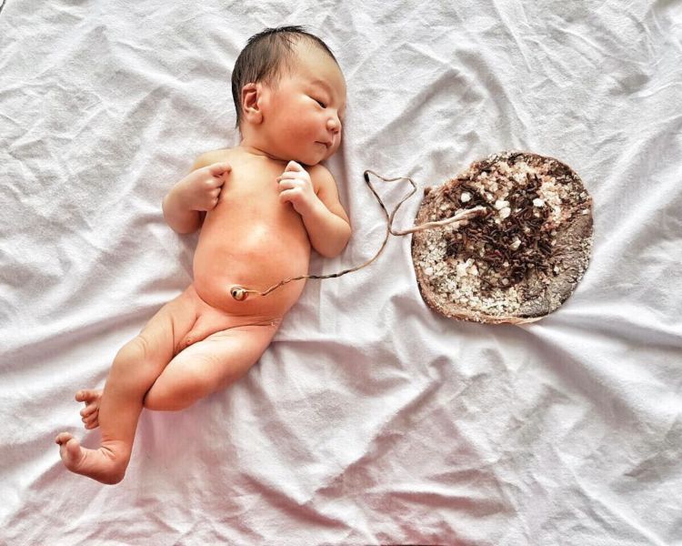 Jika Biasanya Setelah Bayi Lahir Langsung Dipotong Plasentanya, Lotus Birth Tidak. Ini Penjelasannya