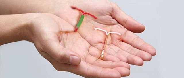 Mengenal Lebih Jauh Tentang IUD. Kok Bisa Sampai Ada Bayi Terlahir dengan Mengenggam Alat Kontrasepsi Ini?