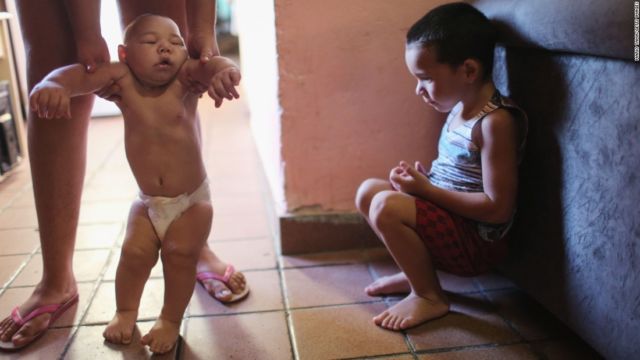 12 Foto Korban Zika Ini Sungguh Memilukan. Meski Situasi Darurat Sudah Lewat, Tetap Perlu Waspada