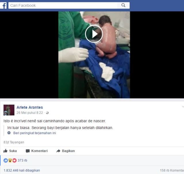 Viral! Sebuah Video Perlihatkan Bayi yang Baru Saja Lahir Mampu Berjalan Kaki, Ini Penjelasannya