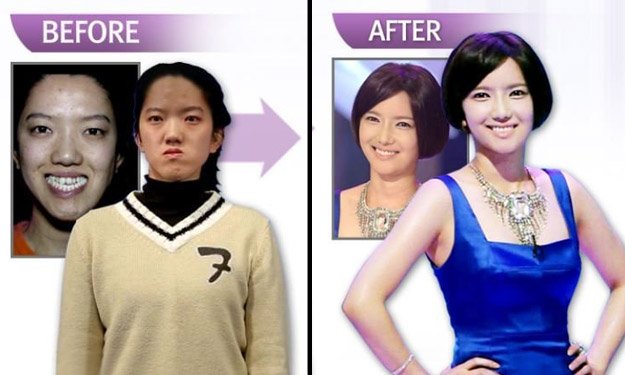 Bukan Pengen Mirip Artis Doang, Ternyata Banyak Orang Korea Itu Operasi Plastik Demi Tuntutan Kerja