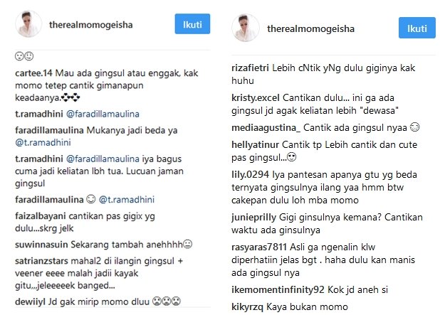 Telah Hilang Gigi Gingsulnya Momo Geisha, Lebih Cantik Nggak? Yang Pasti Doi Jadi Lebih Suka Senyum