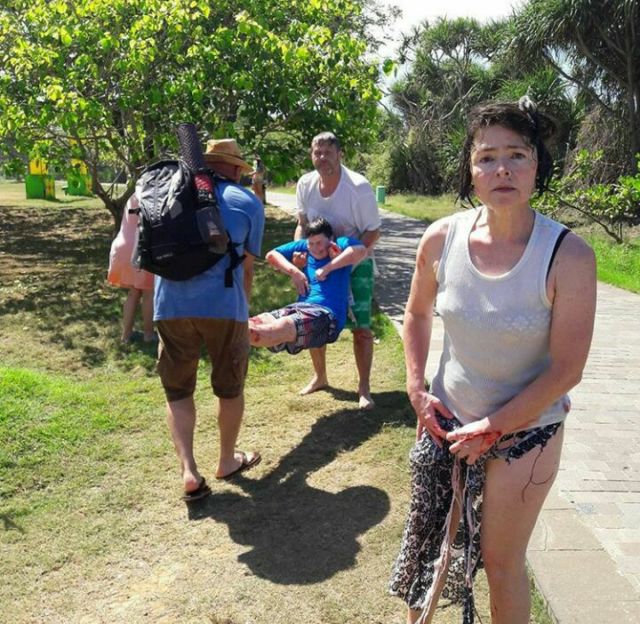 Gara-gara Foto Selfie, Wisatawan Terluka Parah Akibat Terhantam Ombak Besar di Water Blow, Bali!