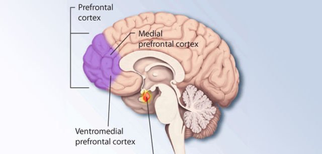 4 Fakta Tentang Tourette, Sindrom yang Sebabkan Tora Sudiro Sampai Terciduk Karena Konsumsi Dumolid