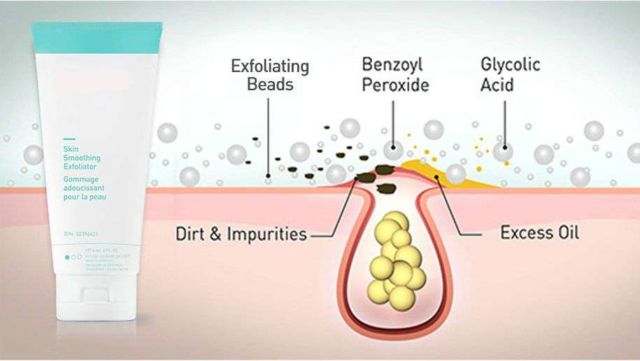 8 Kandungan di Dalam Kosmetik Anti Jerawat. Pelajari Khasiatnya Agar Kulitmu Makin Terawat