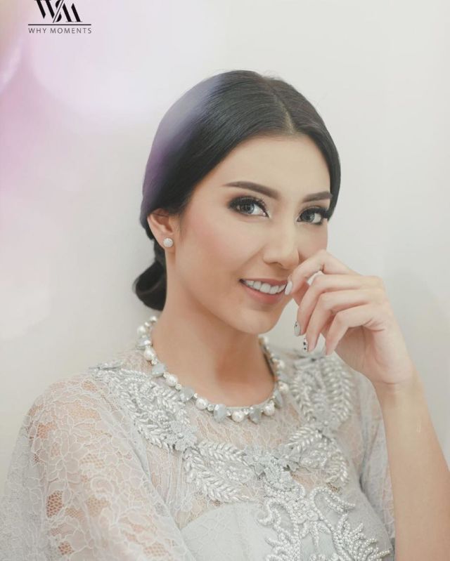 Tren Veneer yang Menyulap Gigi Jadi Putih Mengkilap. Antara Tambah Cantik atau Malah Aneh, Menurutmu?