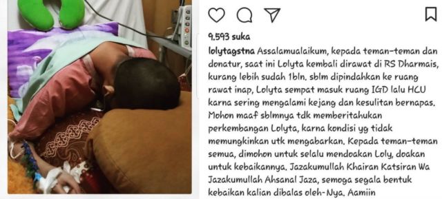 Idap Kanker Langka Selama Setahun, Kini Perjuangan Loly Telah Berakhir