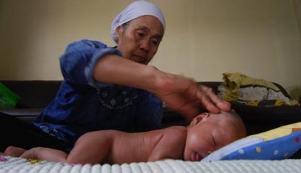 Diduga Karena Sering Dipijat, Bayi Ini Alami Pendarahan Otak