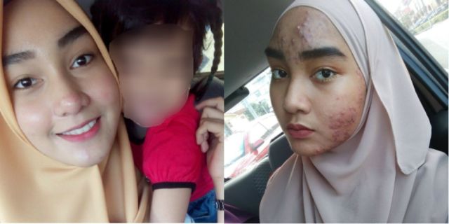 Pengen Punya Fisik Sempurna, 7 Usaha Mempercantik Diri Ini Malah Berujung Petaka. Makanya Bersyukur!