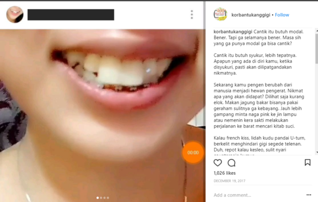 Bunny teeth apaan kalau gini?