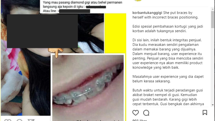 Bongkar 'Aib' Tukang Gigi, Akun IG @korbantukanggigi Tuai Pro-Kontra