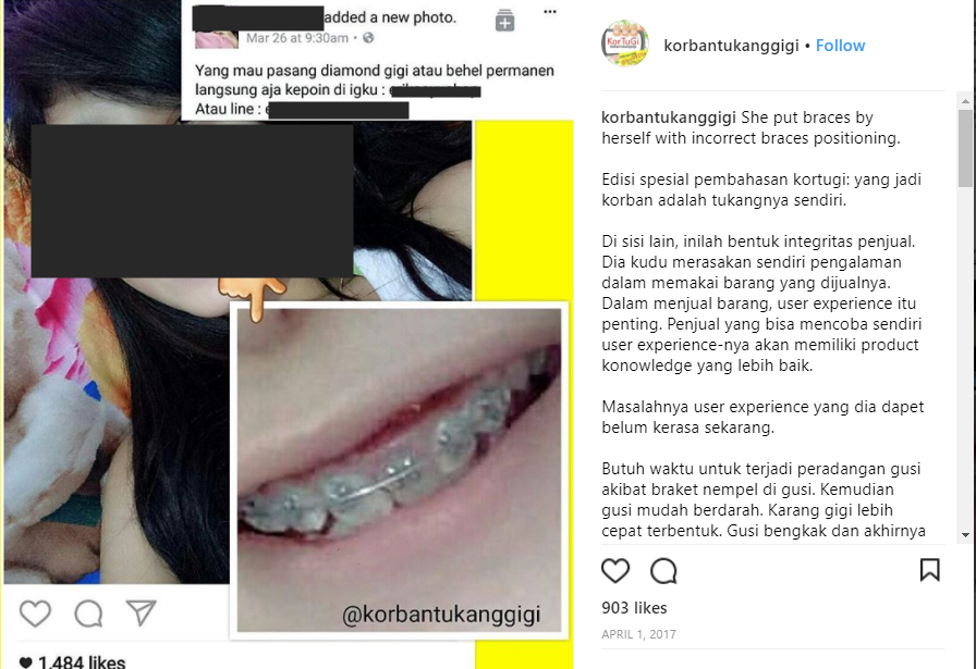 Bongkar 'Aib' Tukang Gigi, Akun IG @korbantukanggigi Tuai Pro-Kontra