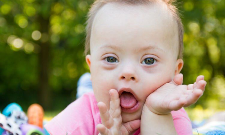 14 Fakta Down Syndrome yang Bukan Cuma Para Ibu, Tapi Semua Orang Wajib Tahu #LotsOfSocks