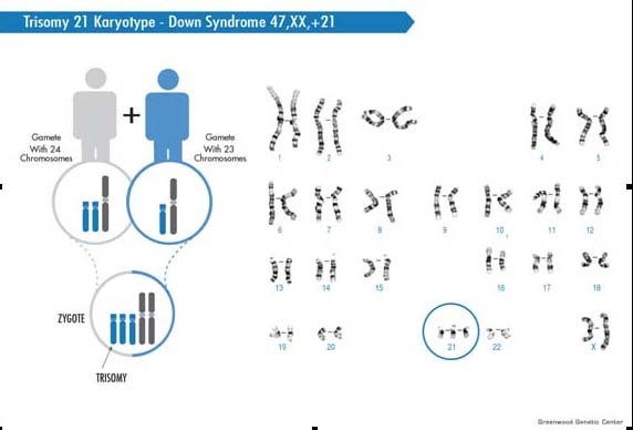 14 Fakta Down Syndrome yang Bukan Cuma Para Ibu, Tapi Semua Orang Wajib Tahu #LotsOfSocks