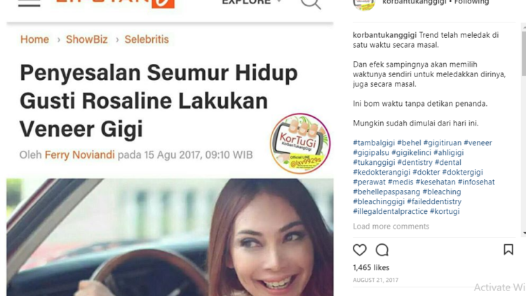 Fakta Soal Veneer Gigi yang Dikupas Habis Akun @korbantukanggigi; Mau Trendi Tapi Malah Rugi