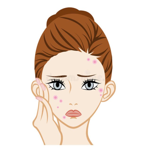 acne illustration