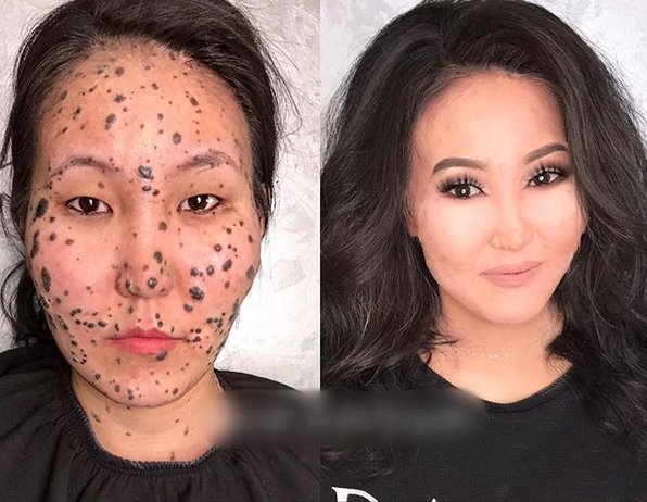 Dengan makeup, Irina bisa tampil normal dan tidak mengundang pandangan yang tidak perlu