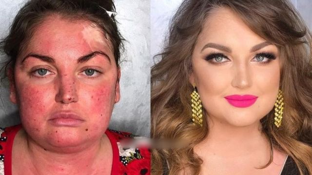 Wanita berkulit kemerahan karena sensitif disulap wajahnya oleh makeup artist terkenal asal Rusia, Goar Avetisyan