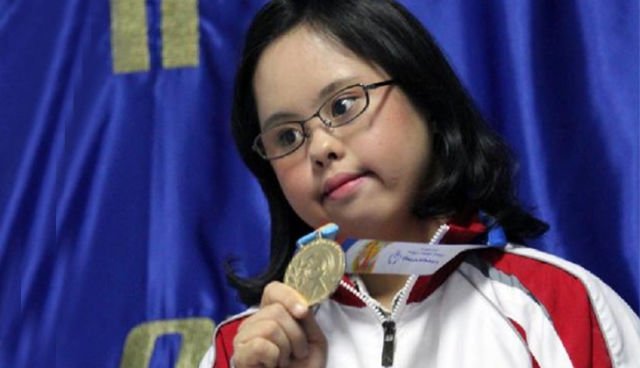 Punya Prestasi Hebat, 7 Penderita Down Syndrome Ini Buktikan Bisa Sukses Meski Sedikit Berbeda