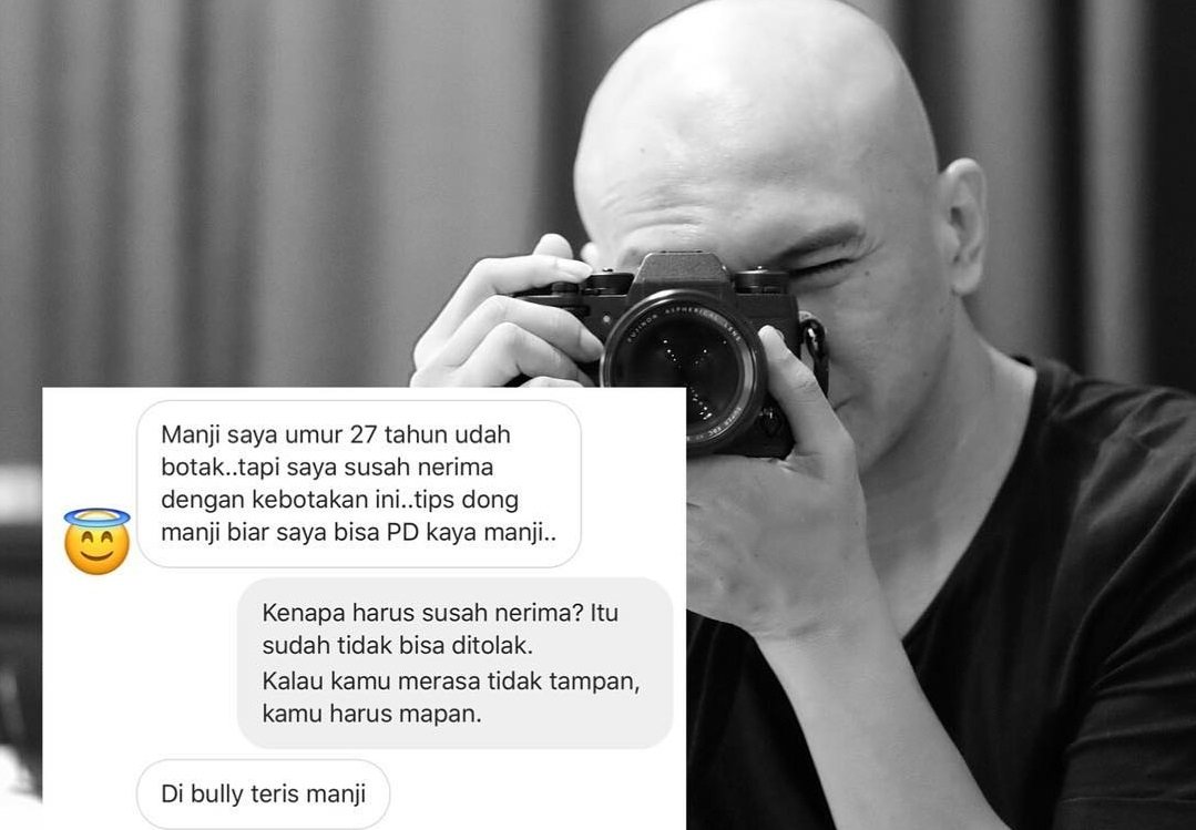 Seorang Warganet Curhat Dibully Karena Botak, Anji Kasih Trik dan Ungkapan yang Memotivasi. Setuju Sih~