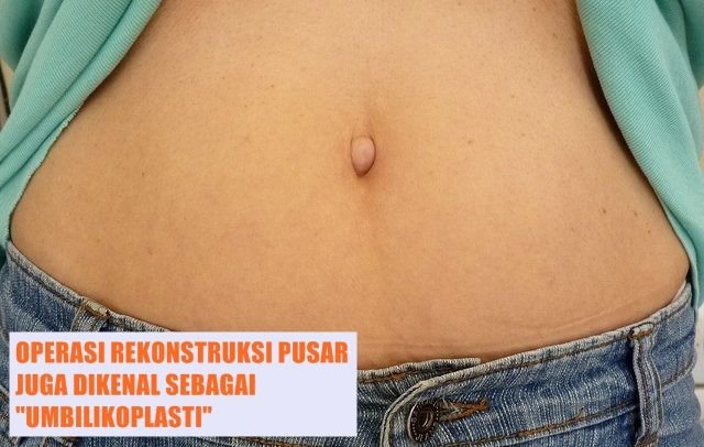 10 Fakta tentang Pusar yang Perlu Kamu Tahu, ternyata Ada juga lho Jenisnya yang Favorit dan Dibenci