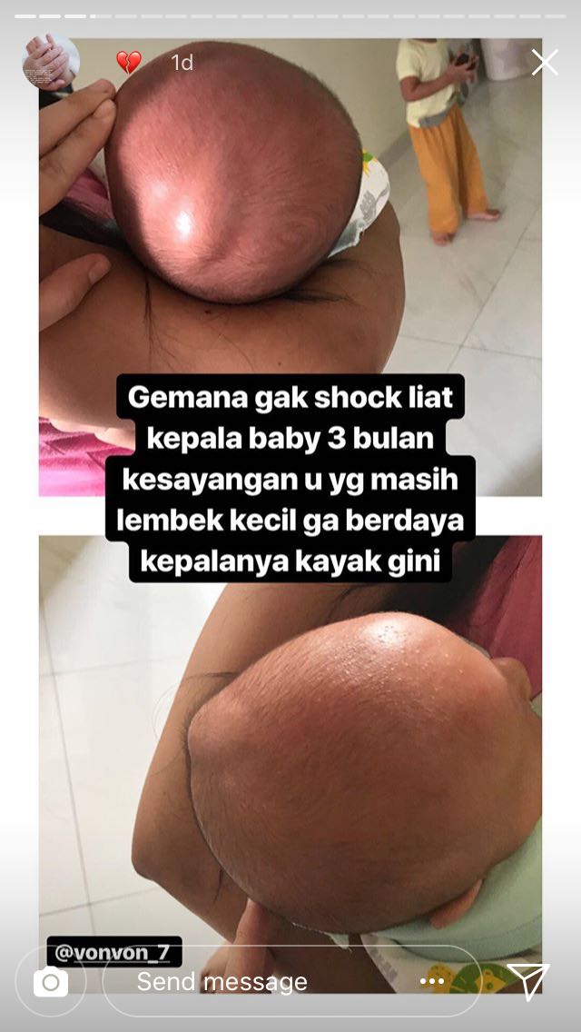 Tragedi Pilu Soal Bayi dan Susternya Diunggah sang Ibu, Warganet Turut Sebarkan Biar Jadi Pelajaran