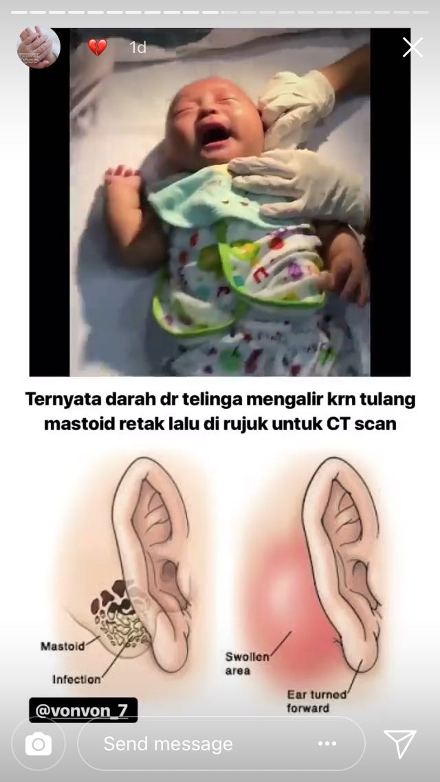 Tragedi Pilu Soal Bayi dan Susternya Diunggah sang Ibu, Warganet Turut Sebarkan Biar Jadi Pelajaran