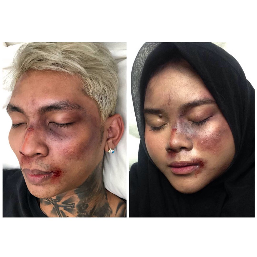 Setelah Young Lex Mengaku Dipukuli K-Popers, Kini Warganet Juga Ikutan 'Dipukuli'. Ngejek nih?