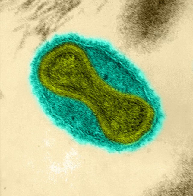 Sekilas Mirip Lukisan, 12 Gambar Ini Adalah Penampakan Virus dan Bakteri yang Diperbesar