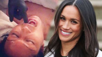 8 Fakta Seputar Facial Buccal, Perawatan ‘Obok-obok Mulut’ Favoritnya Meghan Markle. Katanya Sih Bikin Glowing Instant