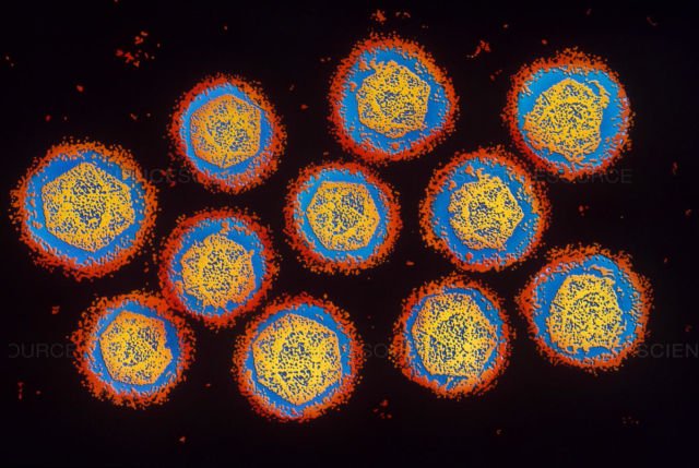 Sekilas Mirip Lukisan, 12 Gambar Ini Adalah Penampakan Virus dan Bakteri yang Diperbesar