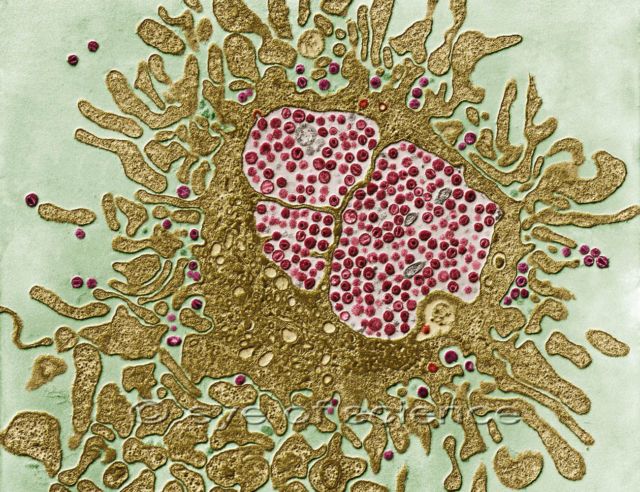 Sekilas Mirip Lukisan, 12 Gambar Ini Adalah Penampakan Virus dan Bakteri yang Diperbesar