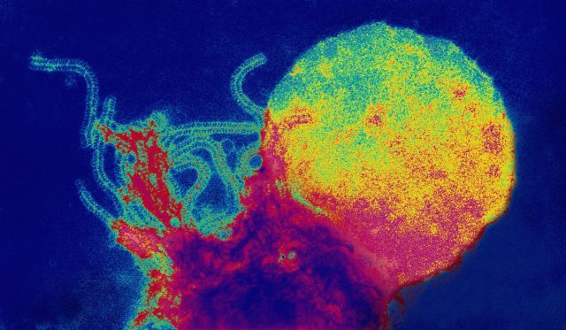 Sekilas Mirip Lukisan, 12 Gambar Ini Adalah Penampakan Virus dan Bakteri yang Diperbesar