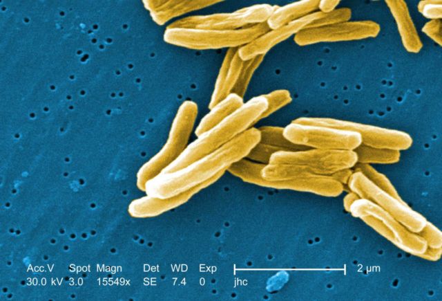 Sekilas Mirip Lukisan, 12 Gambar Ini Adalah Penampakan Virus dan Bakteri yang Diperbesar