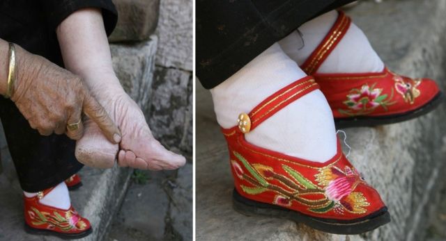 Antara Foot Binding dan High Heels, Perempuan Masih Saja Menyiksa Kakinya Demi Merasa Cantik