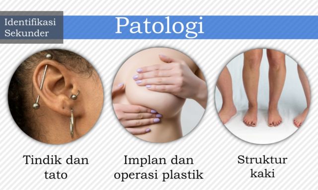 7 Cara Identifikasi Jenazah yang Bisa Diupayakan untuk Kenali Korban. Dari Gigi, DNA, Hingga Tato