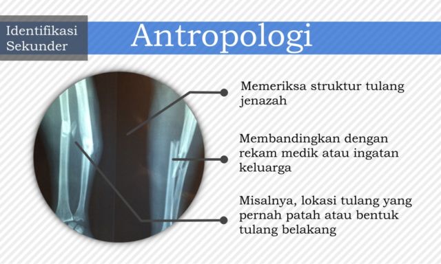 7 Cara Identifikasi Jenazah yang Bisa Diupayakan untuk Kenali Korban. Dari Gigi, DNA, Hingga Tato