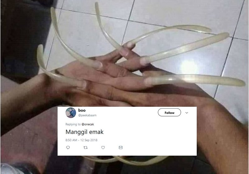 Lihat Kuku Begini, Warganet Jadi Penasaran sama Satu Hal. Tapi Jawabannya Lebih Nggak Masuk Akal sih